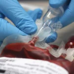 Blood Transfusions